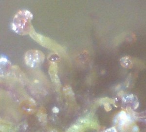 Observación de los tricomas gracias al microscopio digital